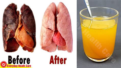 Like most organs, your lungs play a vital role in your overall health and your bodys ability to function properly. . Inhaled food into lung will dissolve reddit